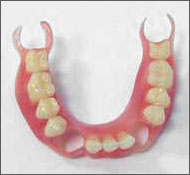 Removable nylon dentures in Chisinau Moldova