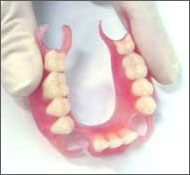 Removable nylon dentures in Kishinev Moldova